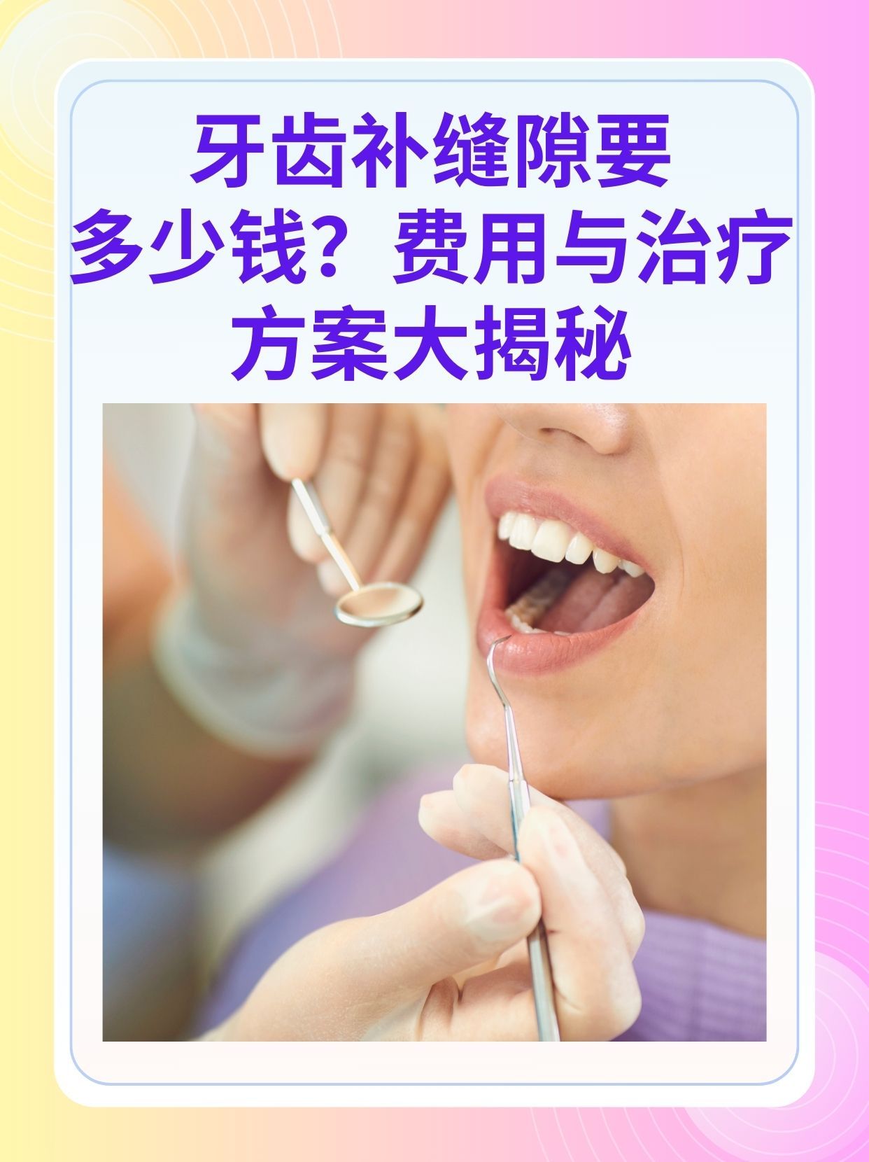 扬州补牙医保可以报销吗(补牙医保可以报销吗 哪些可以报销呢)